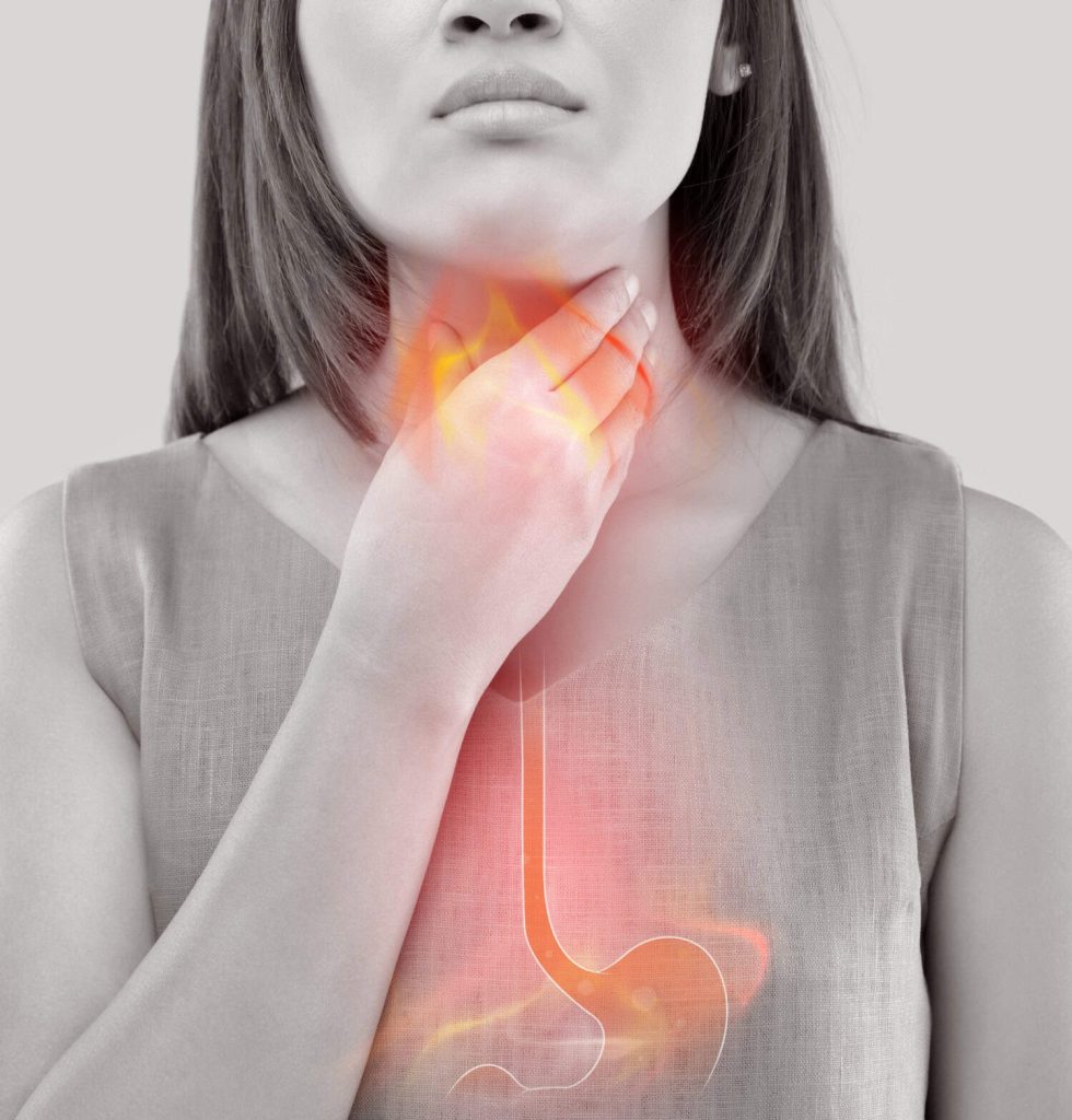 Wat kan je zelf doen bij reflux? Gheeraert Slaapcomfort in Waregem geeft enkele voorzorgsmaatregelen. Al gehoord van en anti trendelenburg?